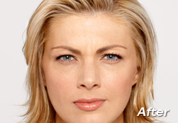 dermatology questions