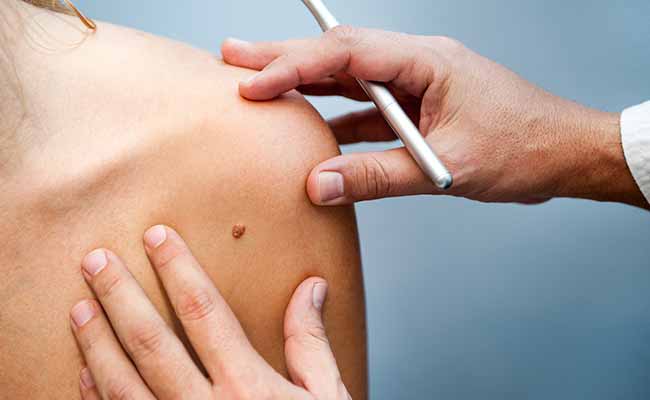 Dr. Selkin of the Center for Dermatology and Cosmetic Laser Surgery in Plano, TX