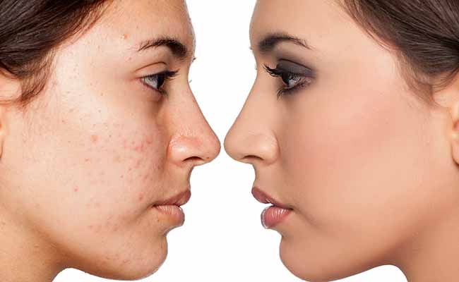 Dr. Bryan Selkin, a dermatologist at the Center for Dermatology and Cosmetic Laser Surgery.