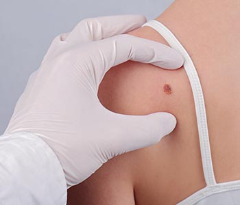 Dr. Selkin Bryan at Dermatology Center explains what Skin diseases and lesions are
