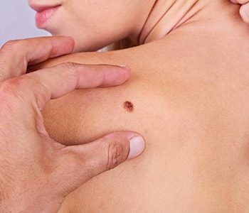 Flower Mound, Texas area Practice Offers Treatment for Varicose Veins
