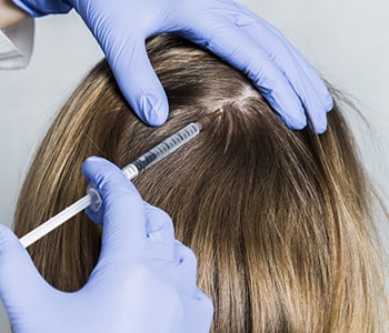 Non Surgical Hair Restoration