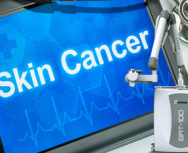 Superficial Radiation Therapy from Dr. Bryan Selkin, Center for Dermatology and Cosmetic Laser Surgery