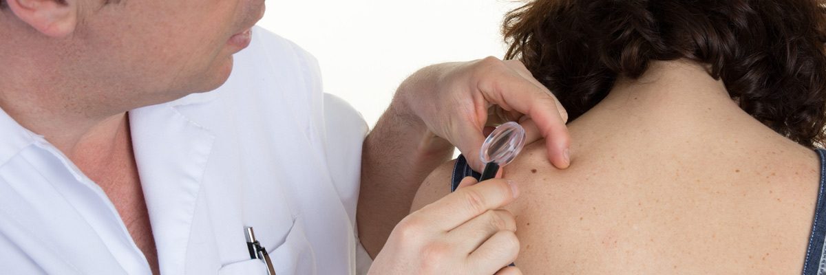 The Gold Standard Treatment for Skin Cancer: Mohs Surgery