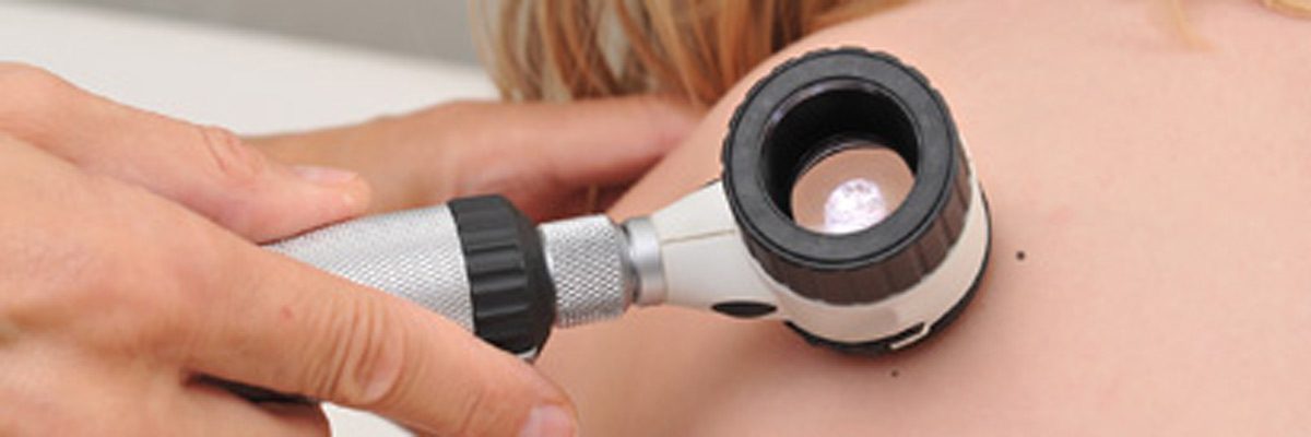 Mohs Skin Cancer Treatment evolves as an option for McKinney Patients