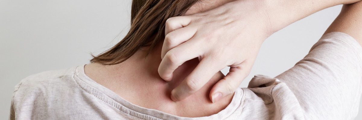 Plano patients ask dermatologist, “How to treat Psoriasis?”