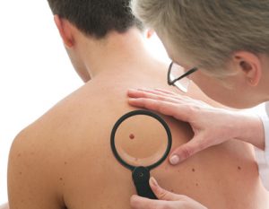 Dermatologist examines a mole of male patient