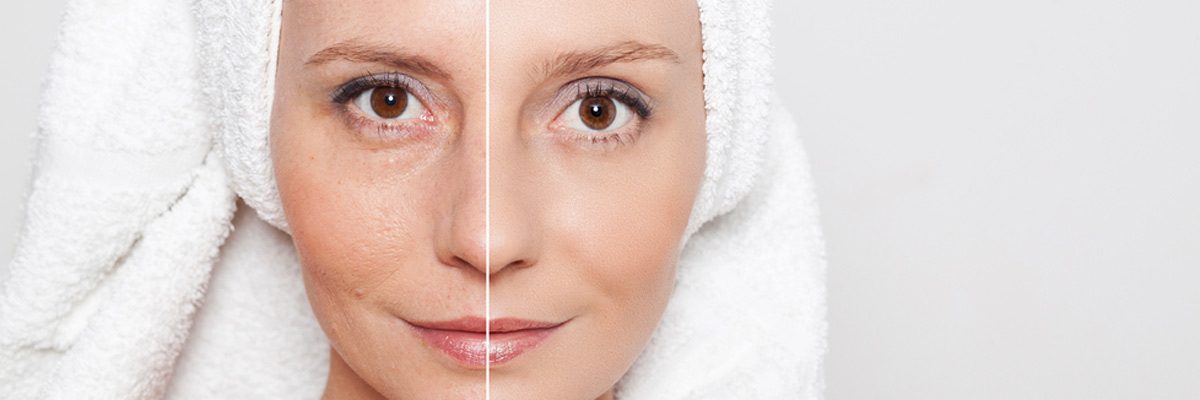 Enjoy Benefits of Laser Skin Tightening Treatments