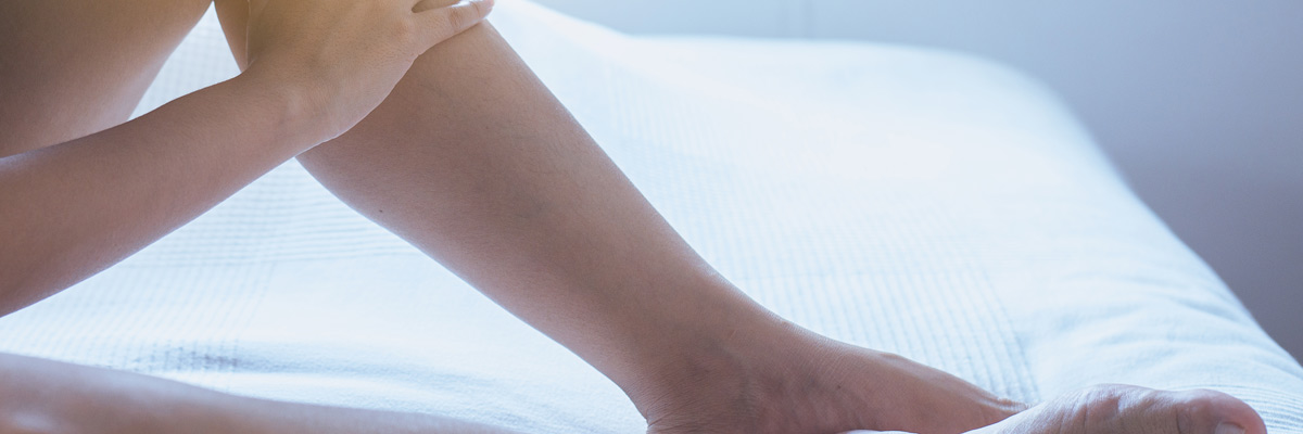 Varicose veins on the womans leg or foot