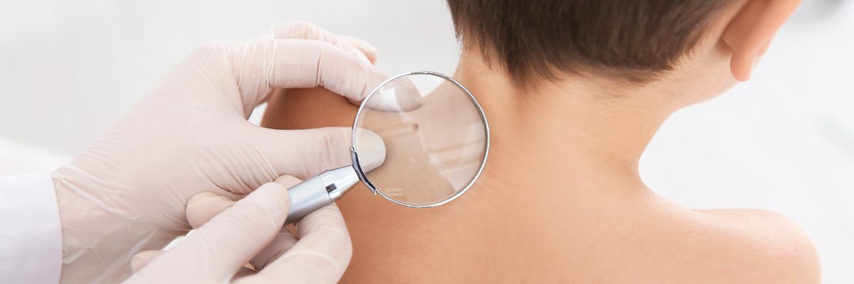 Plano patients ask about pigmented birthmarks