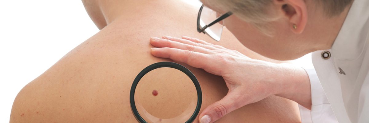 Our Mohs Specialist in Plano Treats Various Forms of Skin Cancer